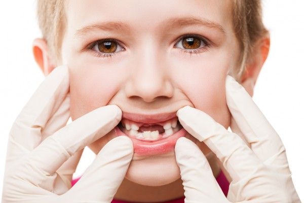 проблемні зуби у дітей